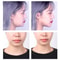 Invisible VLine Face Lifting Sticker Set 4