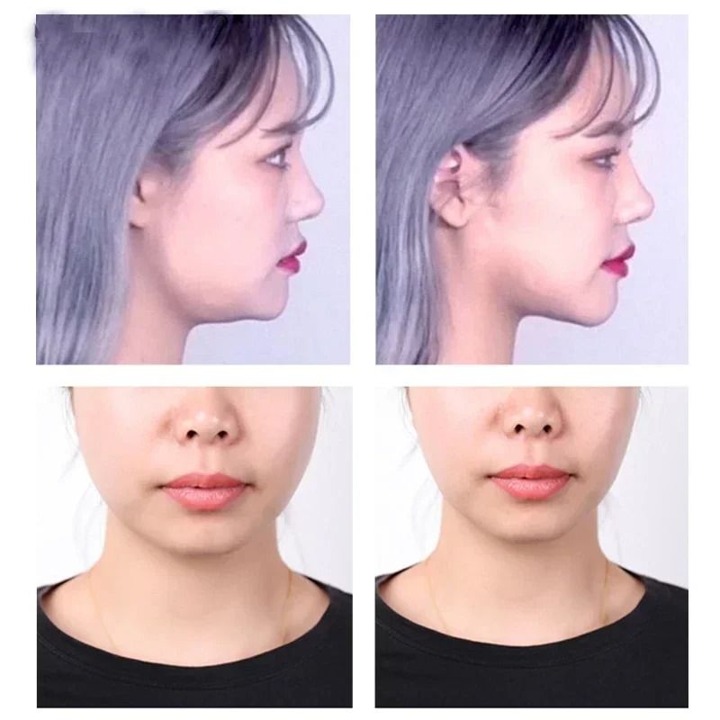 Invisible VLine Face Lifting Sticker Set 4