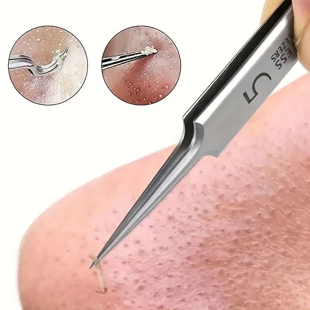 Stainless Steel Tweezers For Powerful Blackhead Removal Professional Skincare Tool 0
