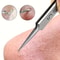 Stainless Steel Tweezers For Powerful Blackhead Removal Professional Skincare Tool 0