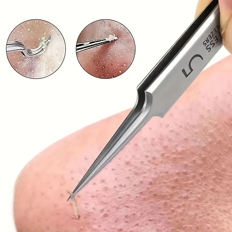 Stainless Steel Tweezers For Powerful Blackhead Removal Professional Skincare Tool 0