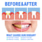 FastActing Gum Repair Serum Soothes Sensitive Teeth Helps Restore Damaged Gums 3