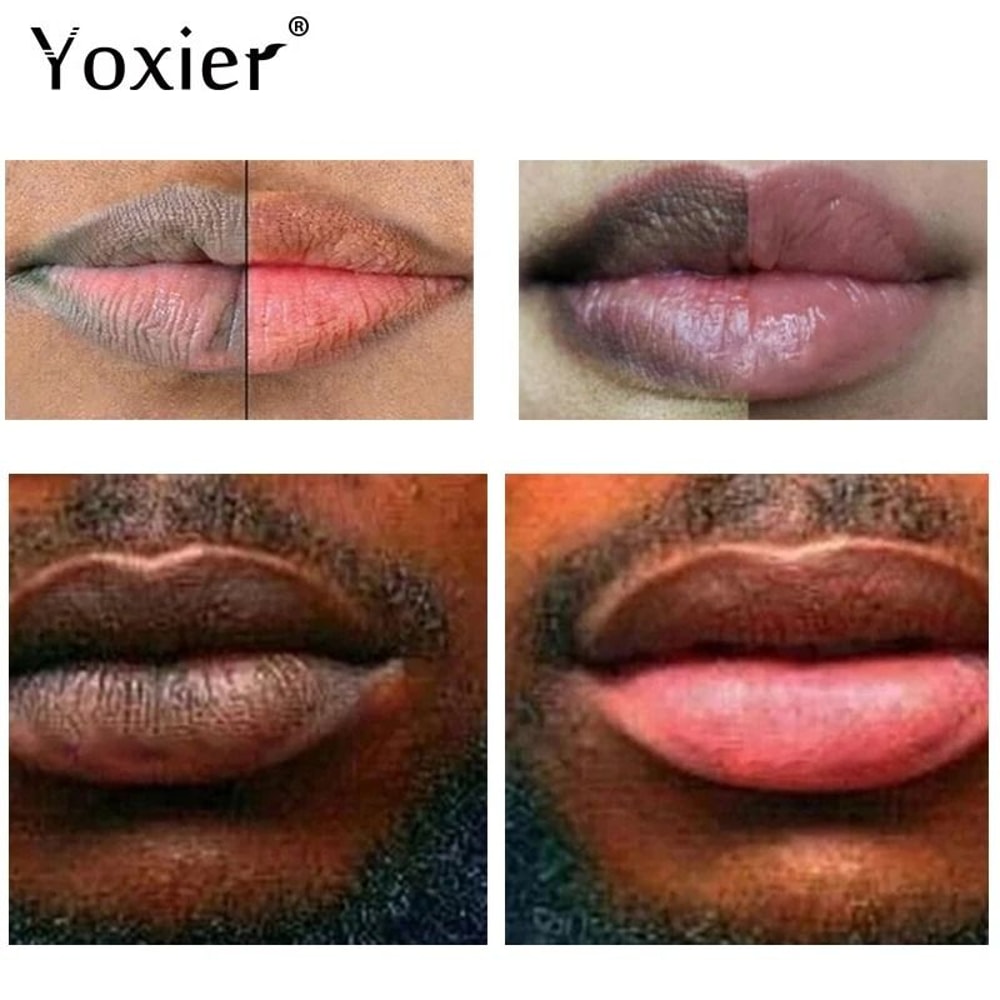 Advanced Lip Lightening Therapy 20g Pigmentation Correcting Brightening Scrub Balm 2