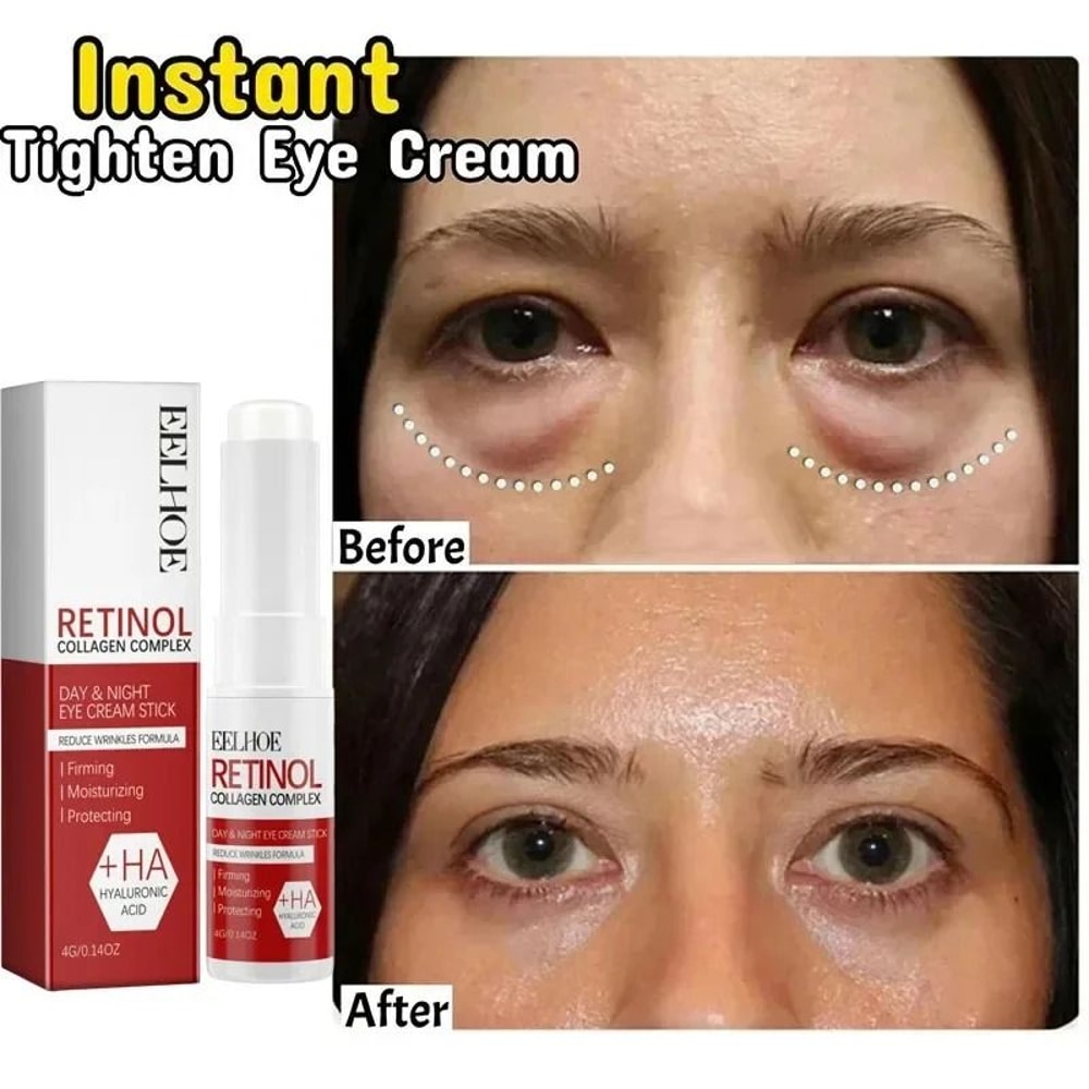 Instant Eye Bag Recovery Cream Advanced Korean Beauty AntiFat Particle Formula 6