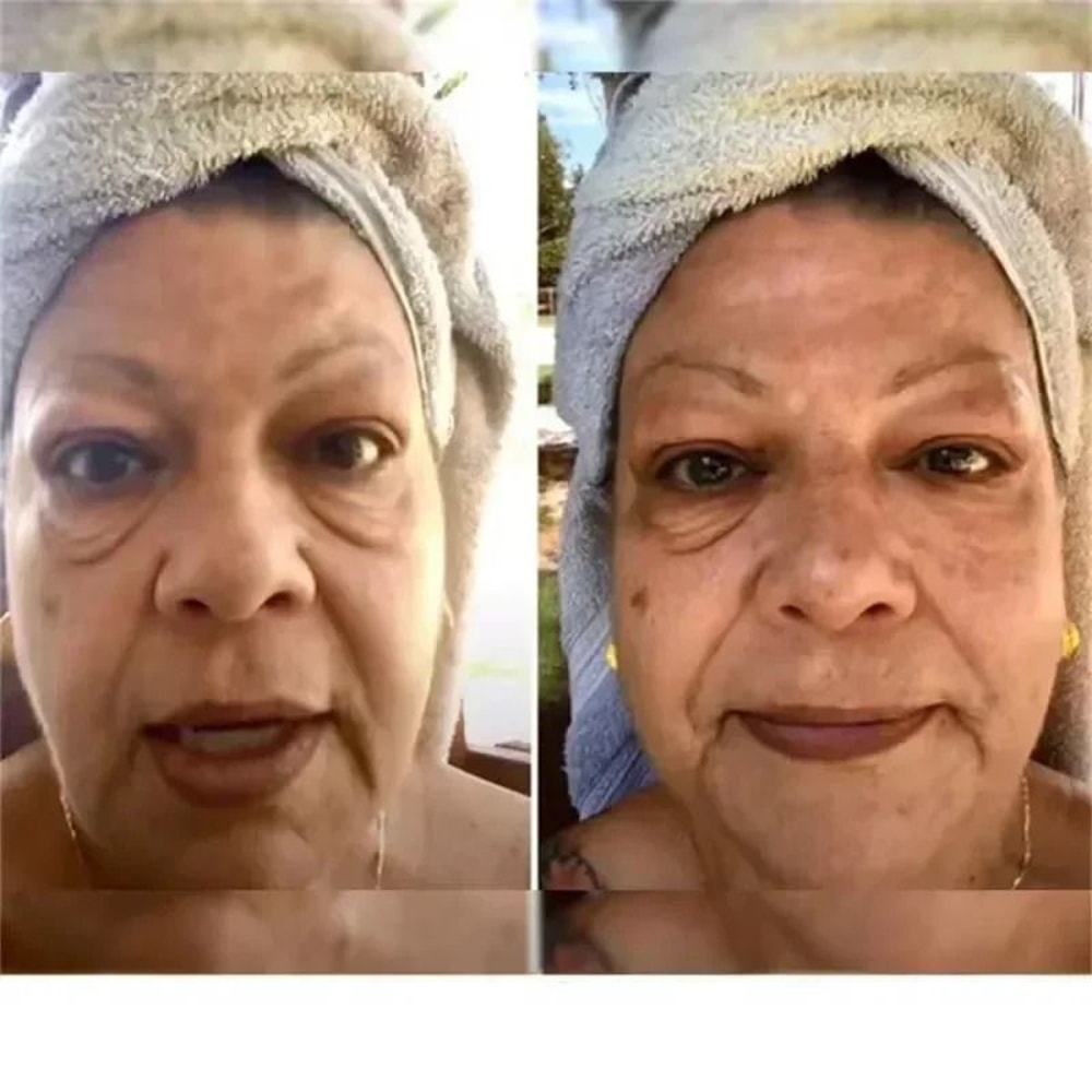 Instant Eye Bag Removal Cream Collagen Infused AntiWrinkle Firming Therapy 2