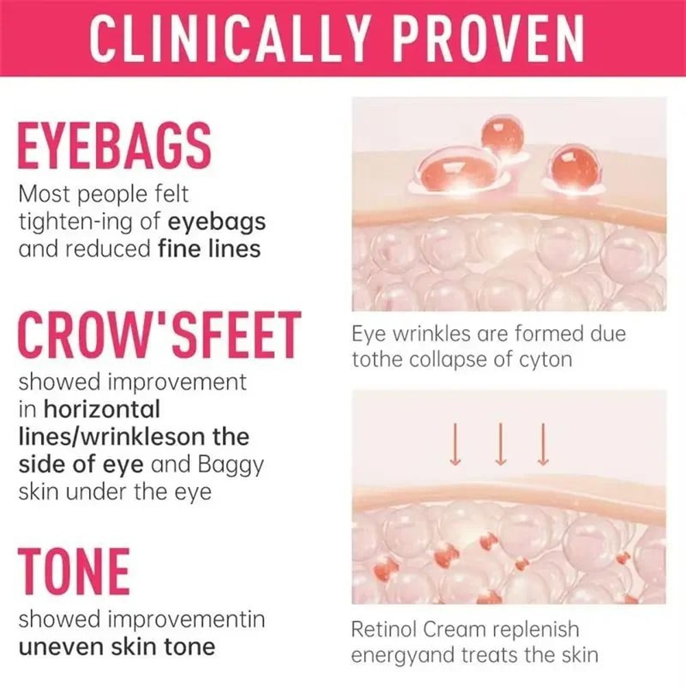 Instant Eye Bag Recovery Cream Retinol Infused AntiWrinkle Firming Therapy 6