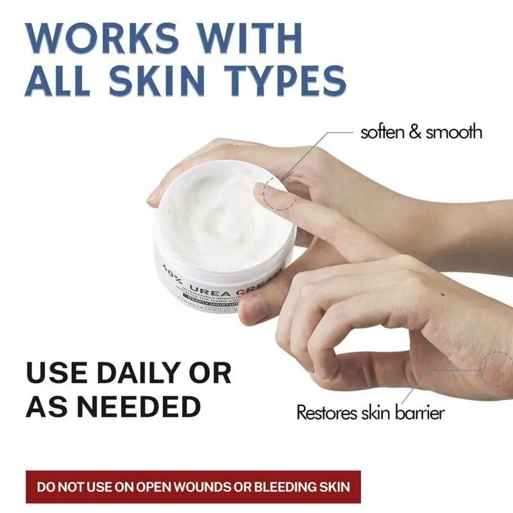 40 Urea Repair Cream 150g Intensive AntiDry Cracking Treatment 3