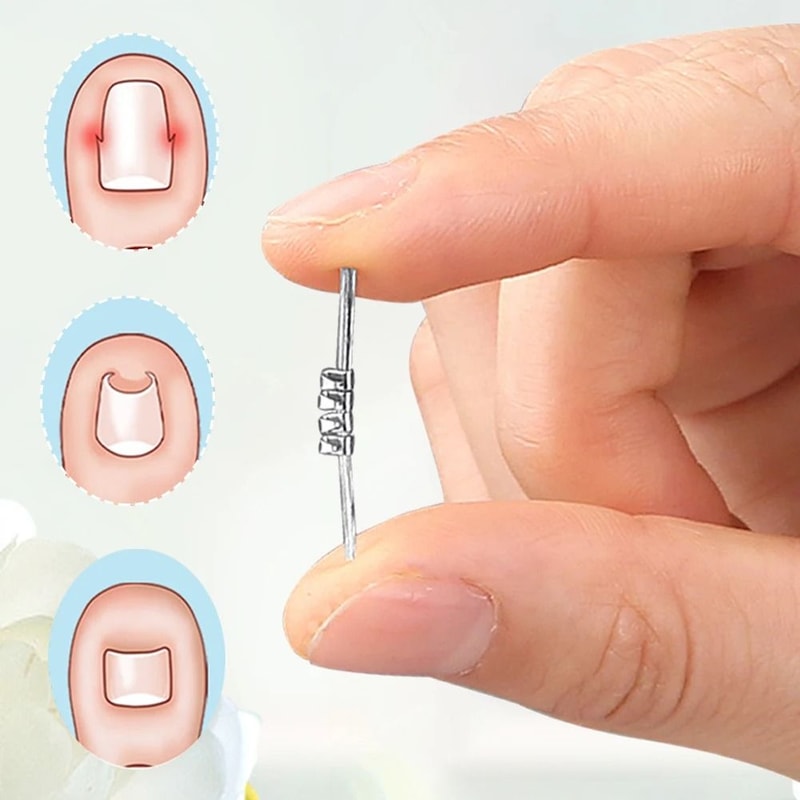 Ingrown Toenail Corrector Precision Leverage Pedicure Tool For Curvature Correction 4