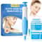 2in1 Auto Skin Tag Remover Kit Micro Large Skin Tag Removal Device Professional Face Body Care 7