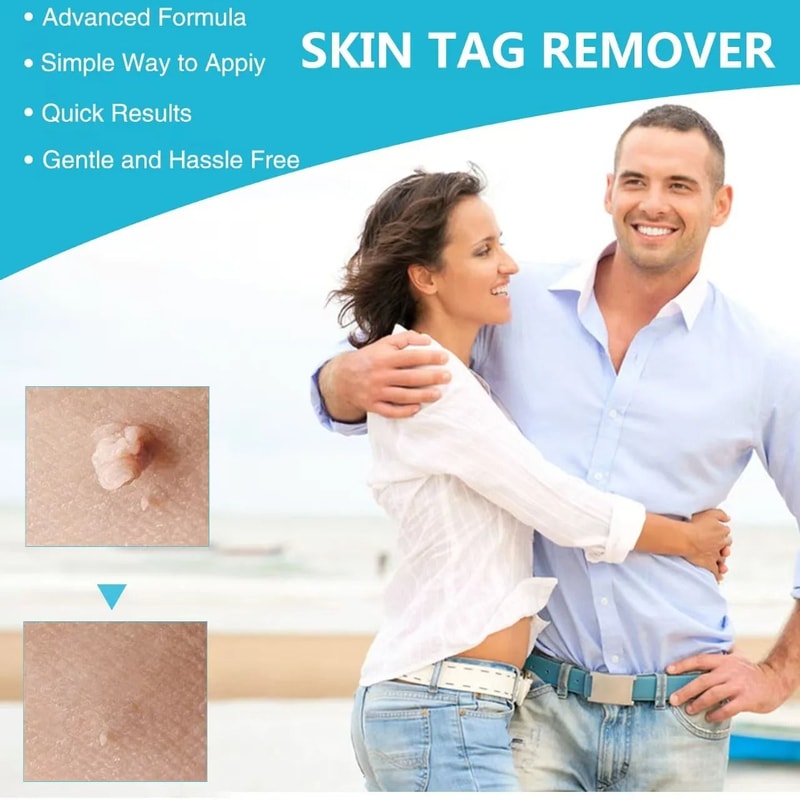 3in1 Auto Skin Tag Removal Kit Painless Mole Wart Removal Equipment Professional Micro Tag Treat 3