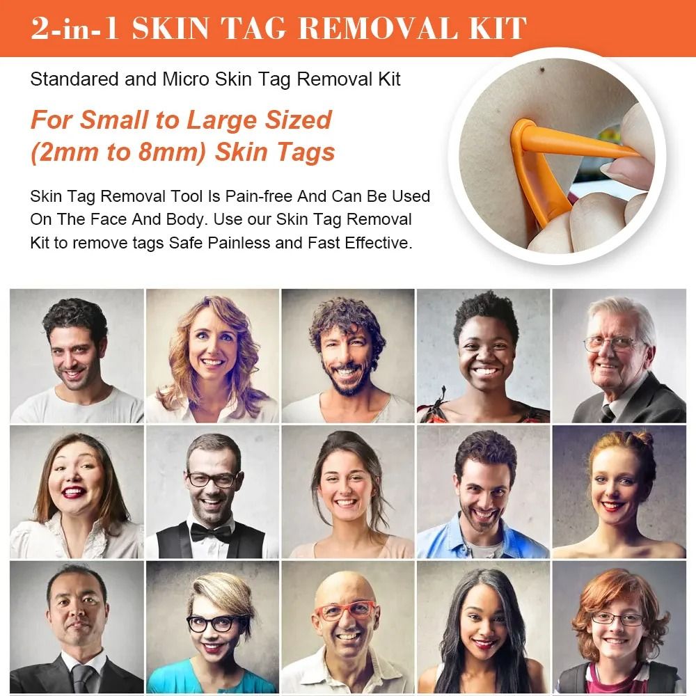 2in1 Auto Skin Tag Removal Kit Painless Skin Label Mole Detailing Tool HighYield Facial Care Int 3