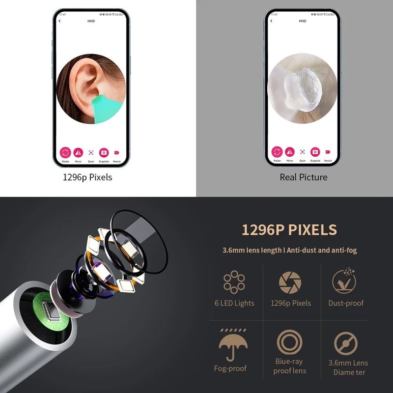 1296P UltraHD Smart Visual Ear Cleaner With WiFi Camera 3