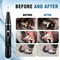 Ultrasonic Pet Dental Scaler HighFrequency Electric Calculus Remover Plaque Defense Kit For Dogs 2