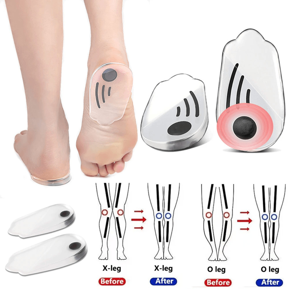 Magnetic Silicone Orthopedic Insoles Plantar Fasciitis Relief Foot Correction Heel Pads For OX Le 1