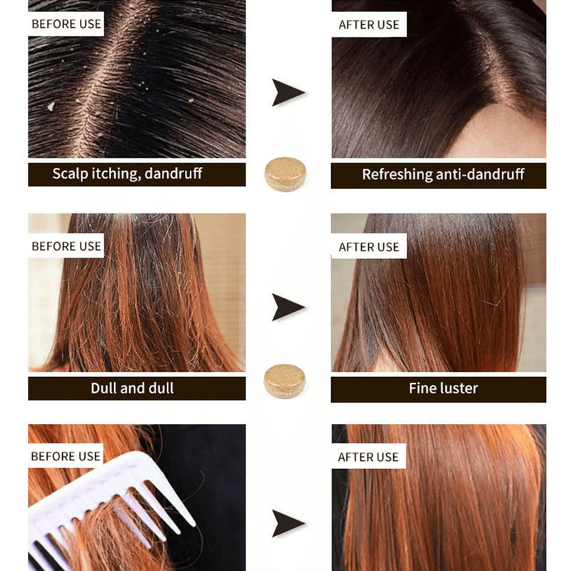 Ginger Polygonum Hair Shampoo Bar Herbal ColdProcessed Soap For Hair Growth And Scalp Care 3