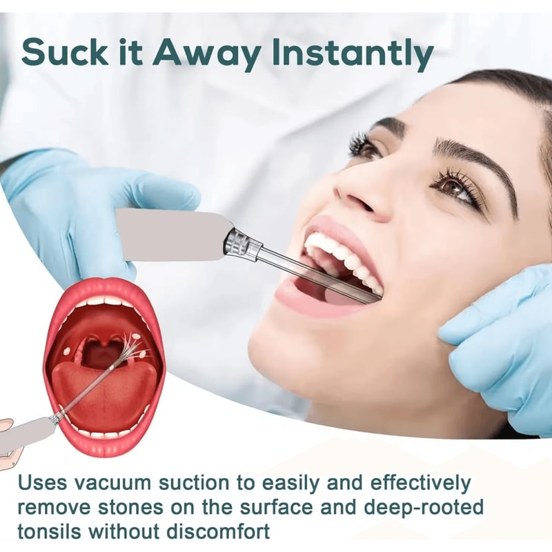 Electronic Tonsil Stone Remover Kit With Suction Modes And Oral Care Tools 2