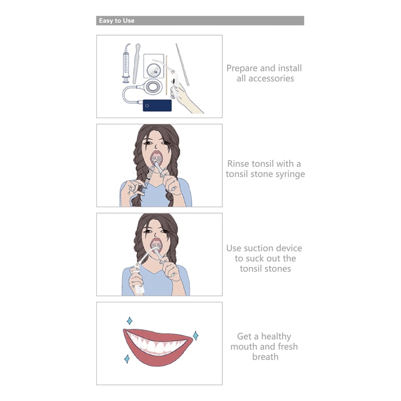 Electronic Tonsil Stone Remover Kit With Suction Modes And Oral Care Tools 4