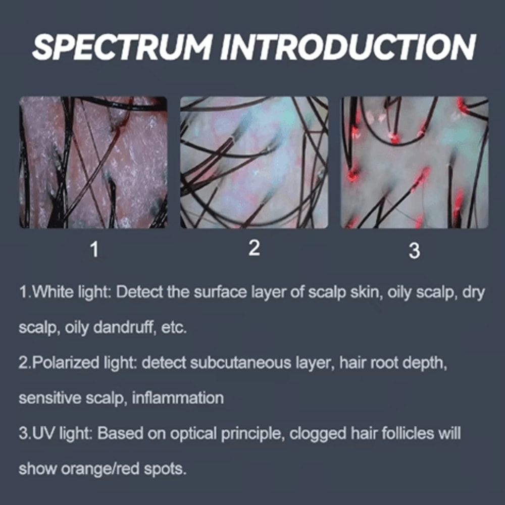 5 In 1 Hair Scalp Analyzer And High Frequency Hair Regrowth Device 3