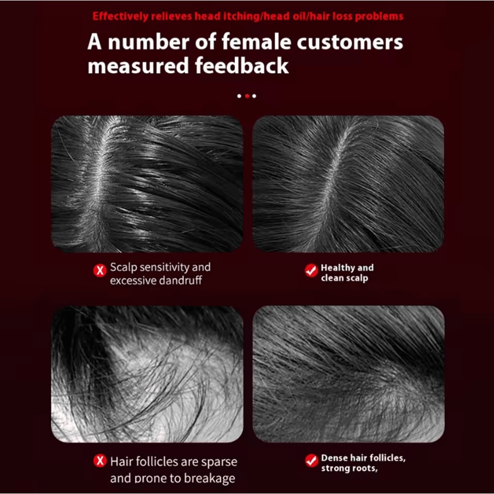 ScalpRevive 3 Mode Electric Massage Comb With Red Light And Essence Applicator 1