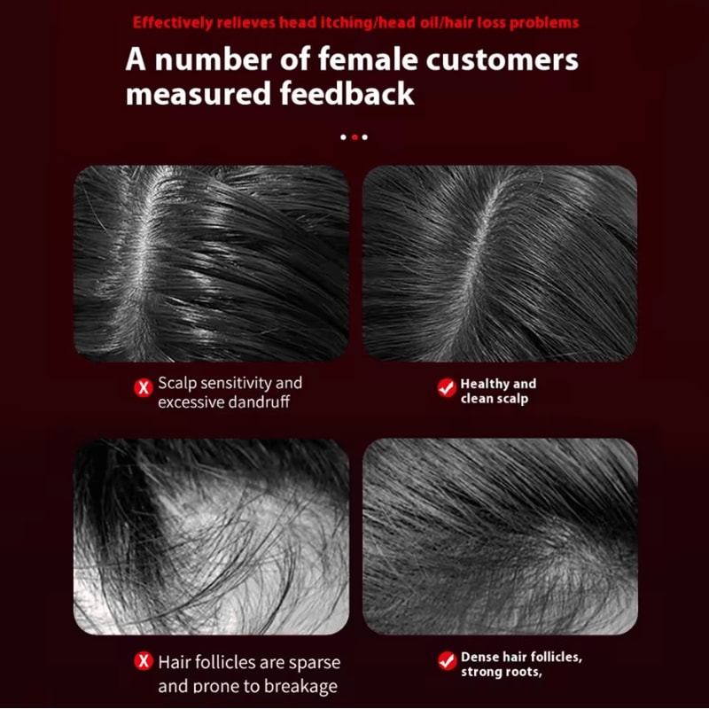 ScalpRevive 3 Mode Electric Massage Comb With Red Light And Essence Applicator 1