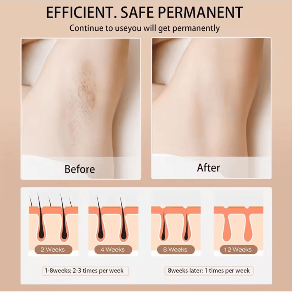 SmoothGlow IPL Hair Removal Device 990000 Flashes For Permanent Results 1