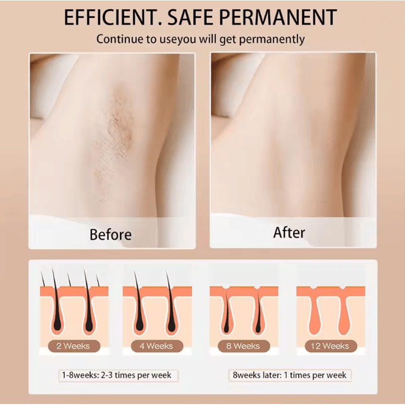 SmoothGlow IPL Hair Removal Device 990000 Flashes For Permanent Results 1