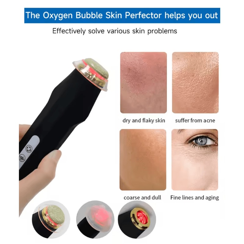 NEWGAGA Portable CO2 Oxygen Bubble Pen Rechargeable Facial Cleansing Device For Anti Aging Skin Car 1