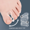 AlignEase Bunion Corrector Toe Spreader Set Hallux Valgus Relief Tool 2