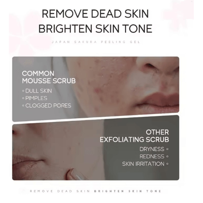 Sakura Peeling Gel Facial Exfoliating Cleanser Moisturizing Pore Care 2