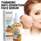 Turmeric Brightening Face Serum For Dark Spot Care 3