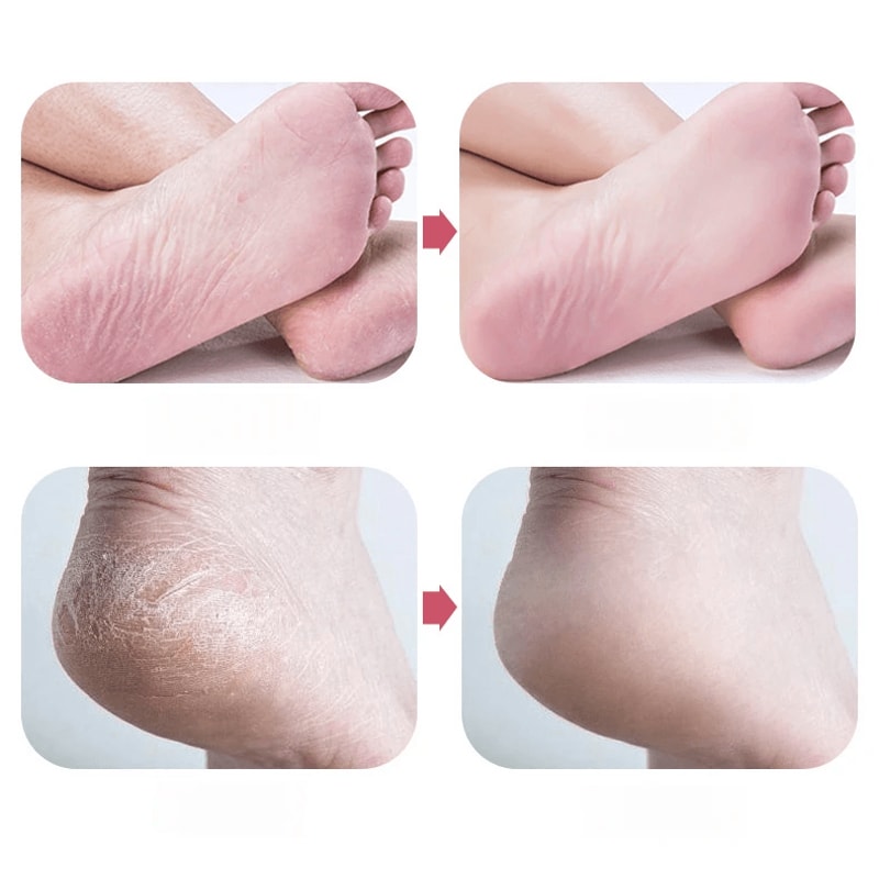 Nano Glass Foot Scrubber Callus Remover Smooth Heel File 1