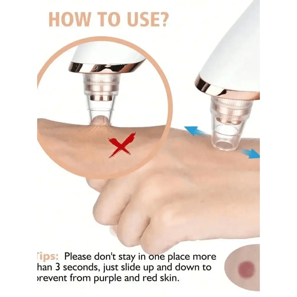 Electric Blackhead Remover Pore Vacuum Facial Deep Cleansing Device 0