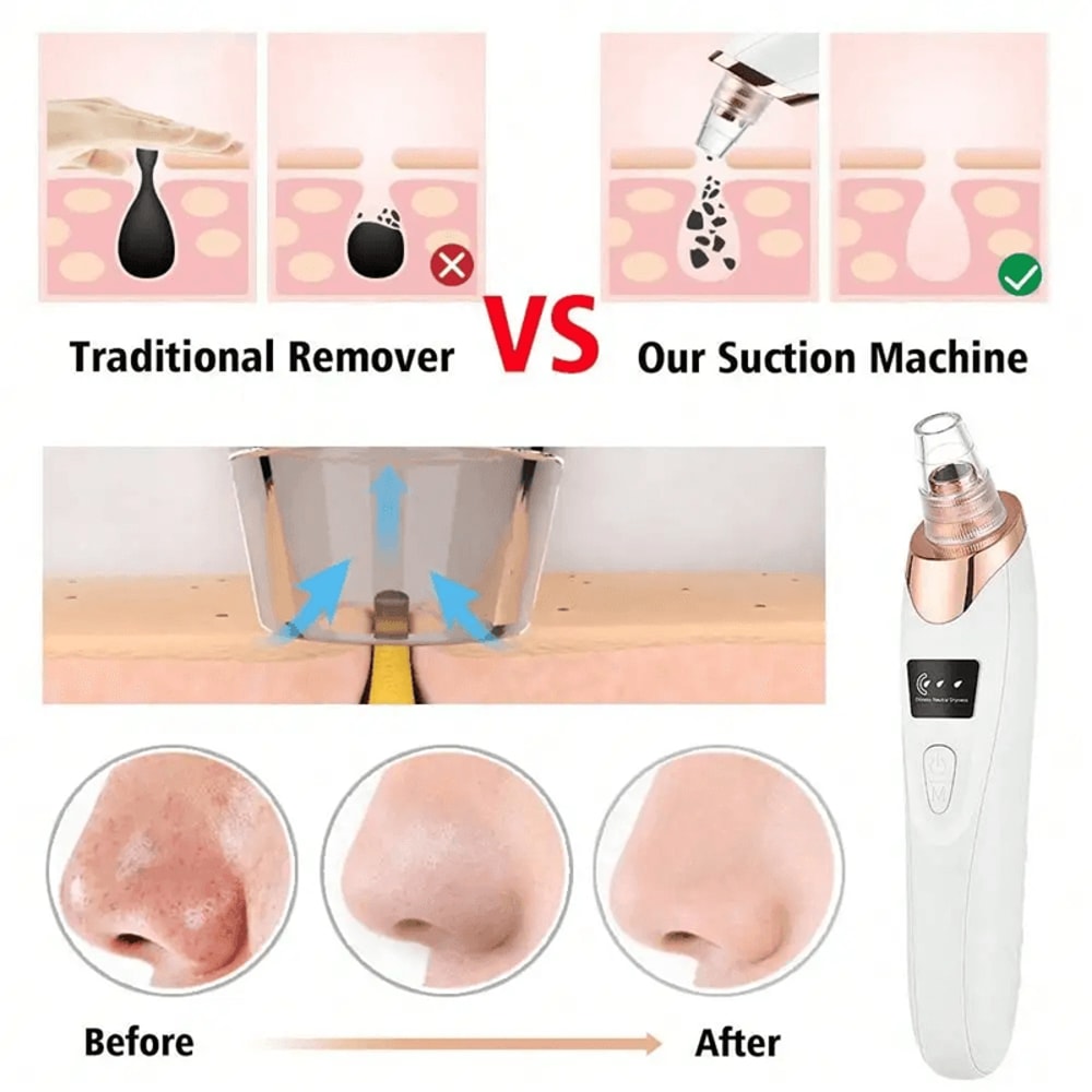 Electric Blackhead Remover Pore Vacuum Facial Deep Cleansing Device 2