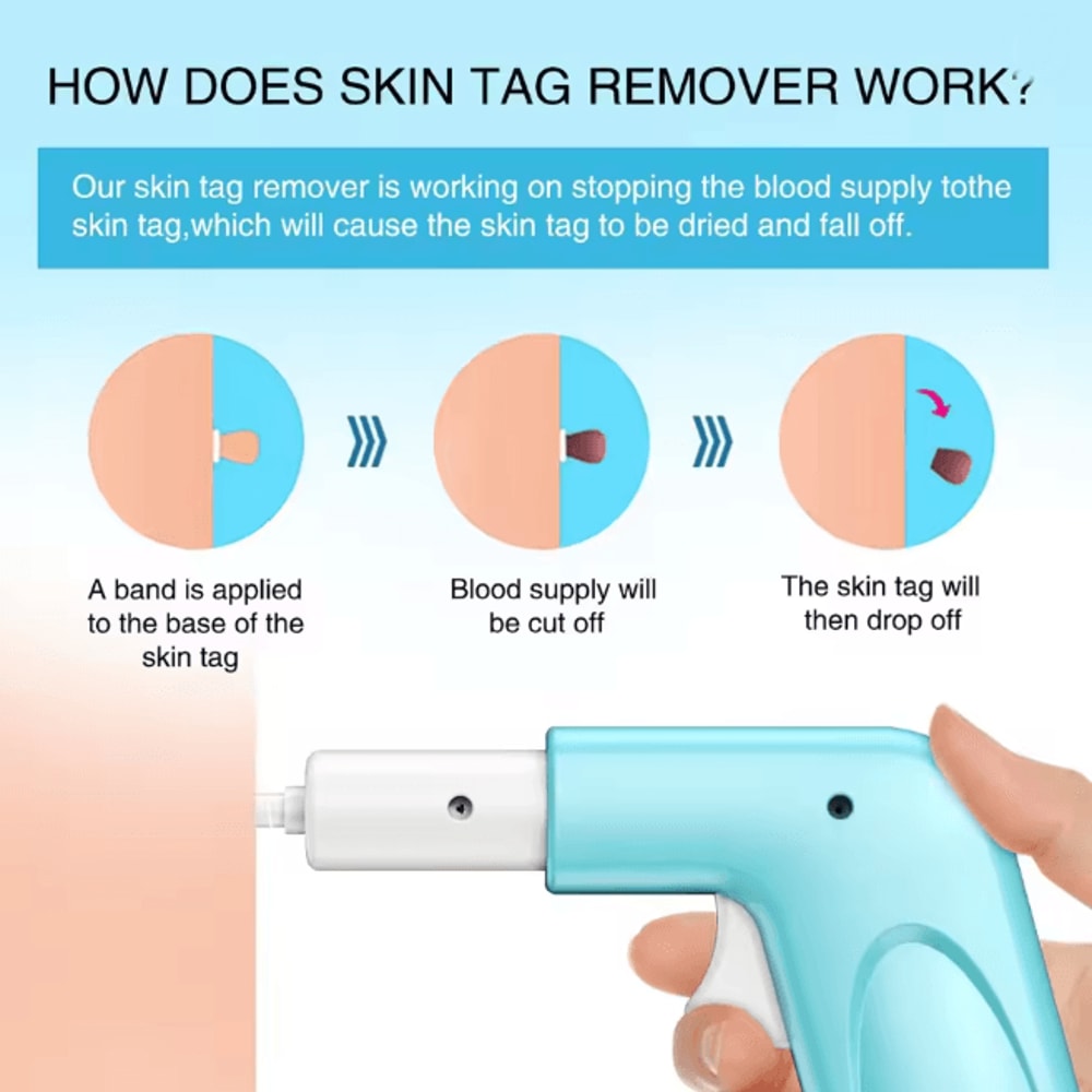 3 In 1 Skin Tag Removal Kit Easy Clean Home Skin Care Tool 2