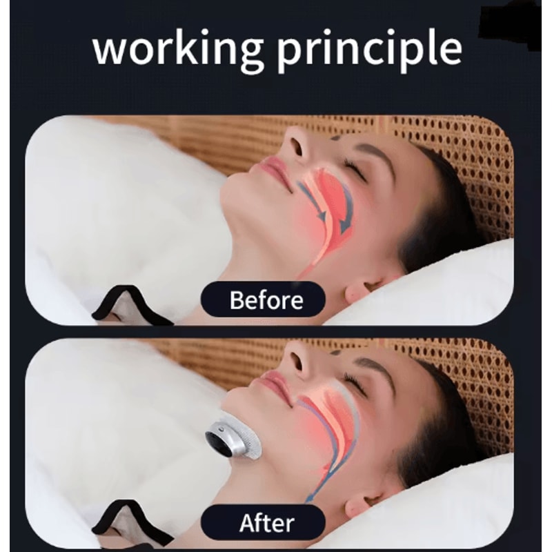 Smart Anti Snoring Device Easy Breathe Sleep Aid With EMS Support 1