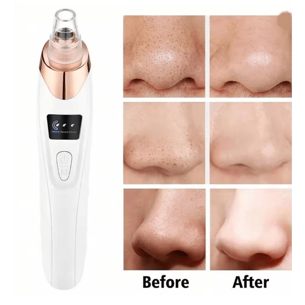 ClearGlow Facial Pore Cleaner Blackhead Remover Vacuum Kit 0