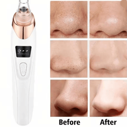clearglow facial pore cleaner blackhead remover vacuum kit
