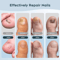 ClearNail Laser Nail Fungus Treatment Device For Toenail Care 3