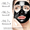 LANBENA Deep Clean Blackhead Removal Mask 3