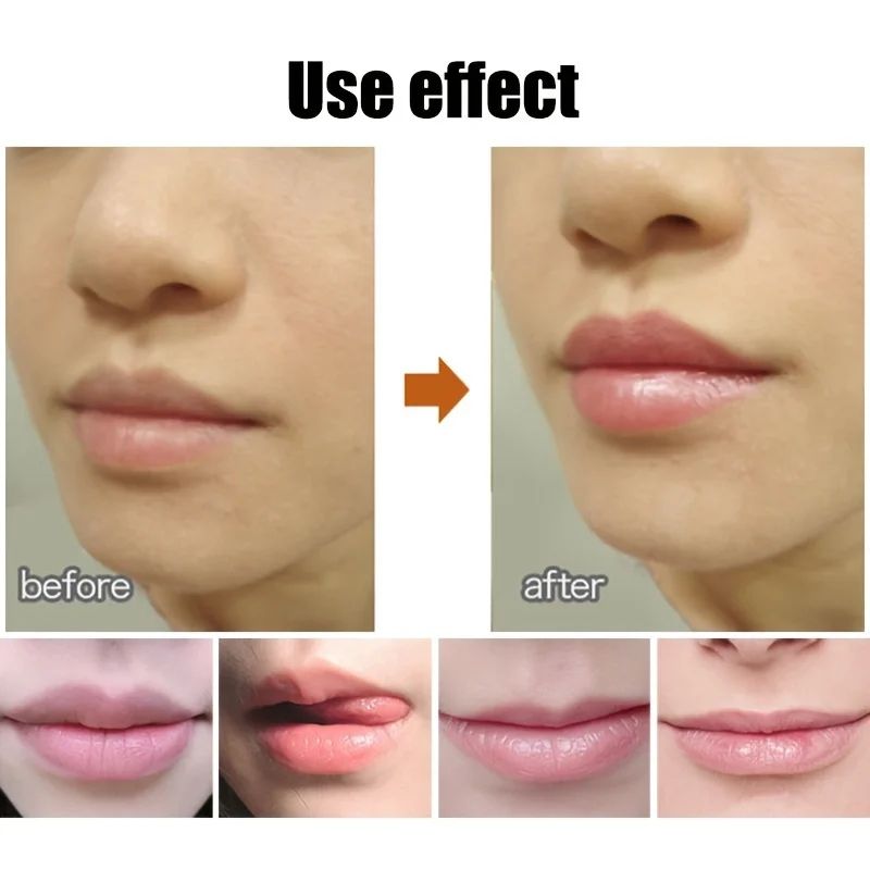 Cute Ball Lip Balm Hydrating Lip Balm Moisturizing Lip Care 3