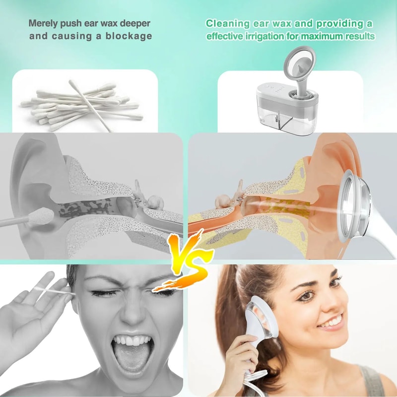 Electric Ear Cleaner Ear Wax Removal Kit Safe Ear Irrigation System 5