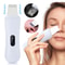 Ultrasonic Skin Scrubber Deep Pore Facial Cleansing And Lifting Device 1