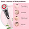 Electric Facial Massager Skin Rejuvenation Lifting And Tightening Device 3
