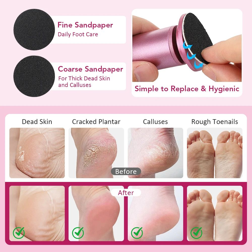 Electric Foot File Callus Remover With Adjustable Speed And 20 Sandpaper Discs 1