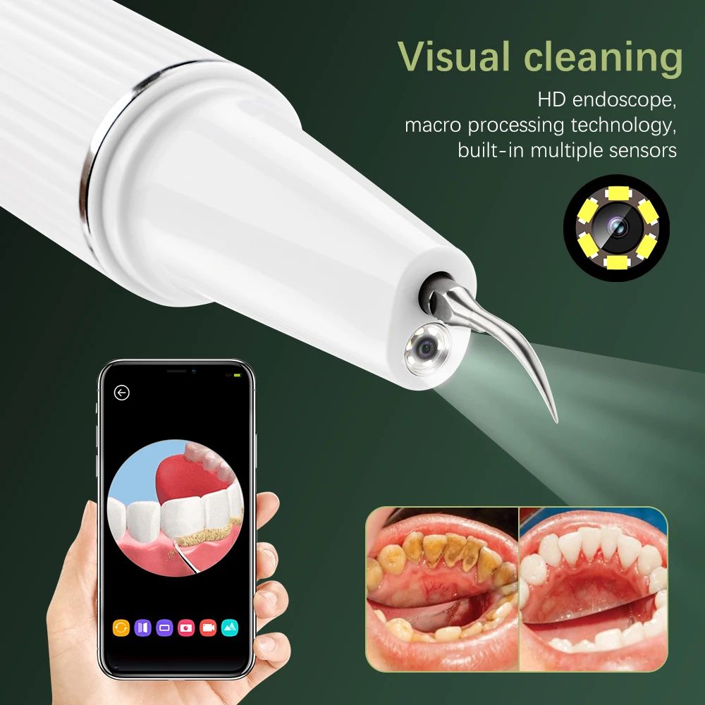 Ultrasonic Dental Scaler Tooth Cleaner Tartar Remover With Visual Cleaning 3