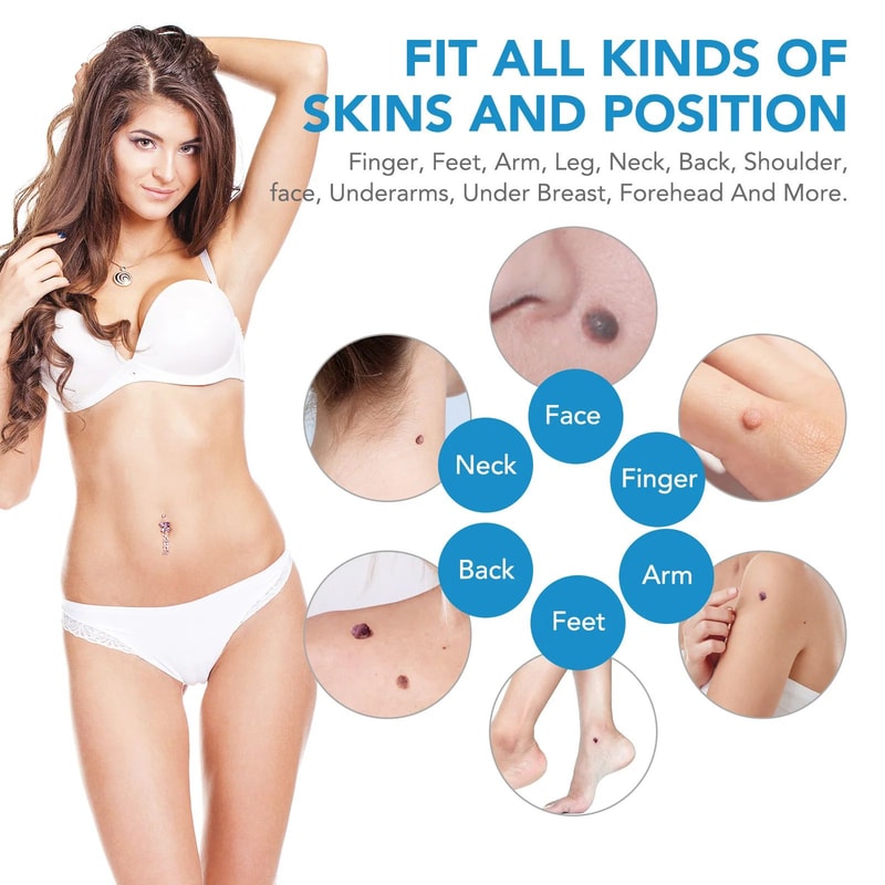 2 In 1 Skin Tag Remover Device For Safe And Precise Skin Care 2