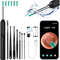 Smart HD Ear Wax Remover With Camera  1080P Otoscope  LED Ear Cleaner Set 3