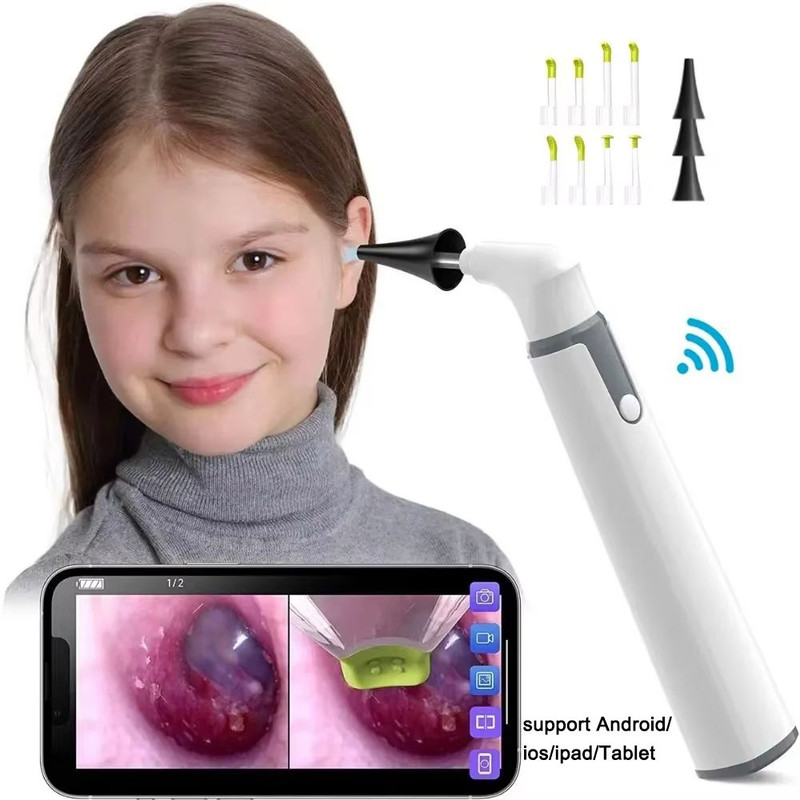 Wireless Otoscope Ear Camera 1080P HD WiFi Ear Scope With LED Lights For Kids Adults 0