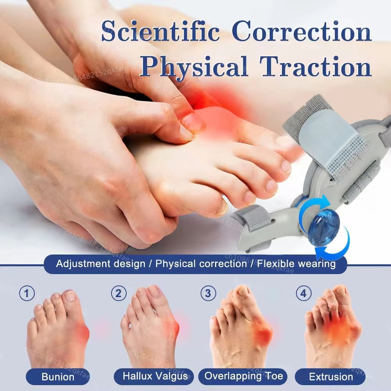 Adjustable Bunion Corrector  Big Toe Straightener And Hallux Valgus Support With Rotating Alignment 3