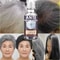 Natural Gray Hair Restoring Serum White Hair Treatment To Revive Original Color In 7 Days 3
